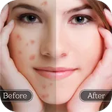 Blemish Remover icon